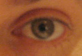 Eye2