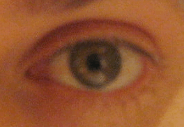 Eye3