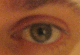 Eye6